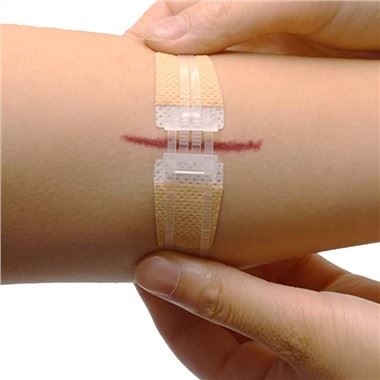 胶粘剂蝴蝶绷带紧急拉链缝合伤口关闭伤口护理急救
